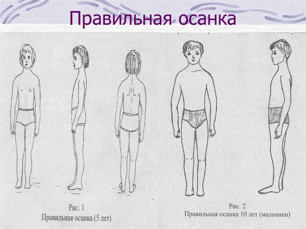 Тестовая карта для выявления нарушений осанки