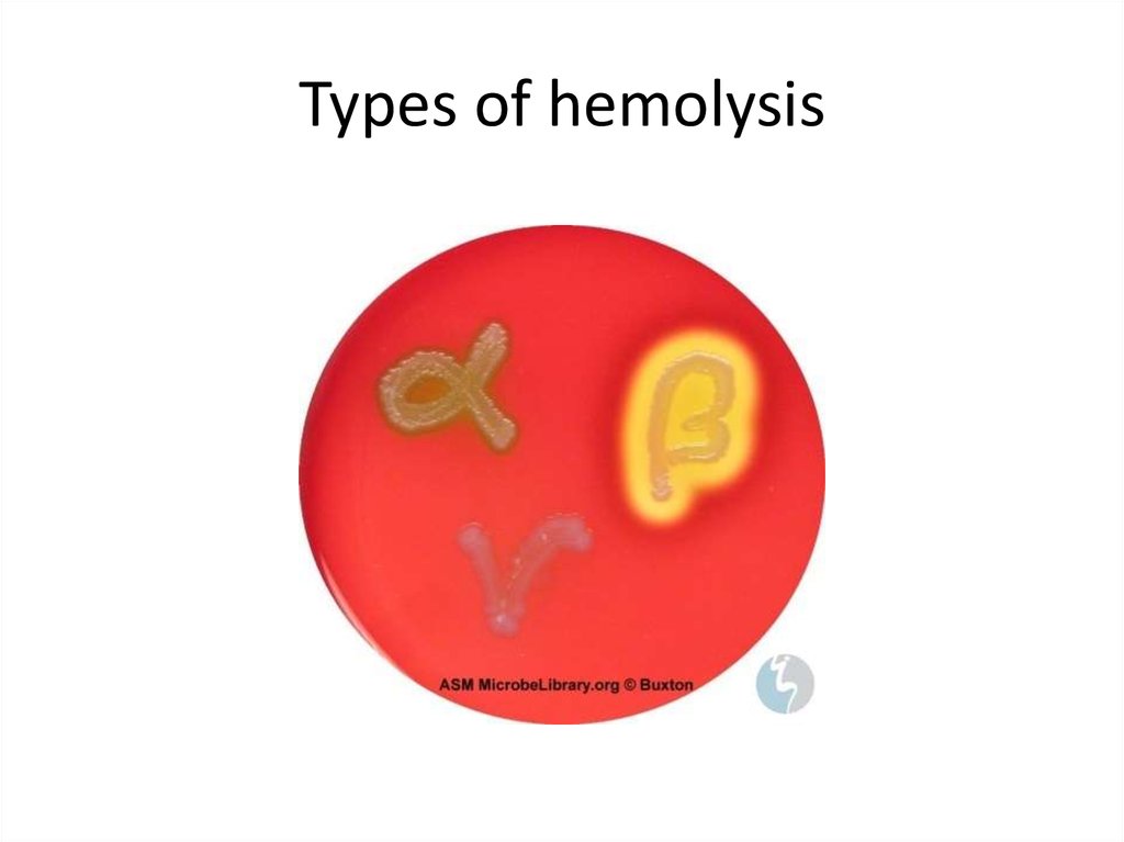 Объясните значение тэ haemolysis. Alpha hemolysis. Hemolysis PNG. Non hemolysis в моче. Пробиотиков e. coli Nisle 1917 и s. salivarius k12..