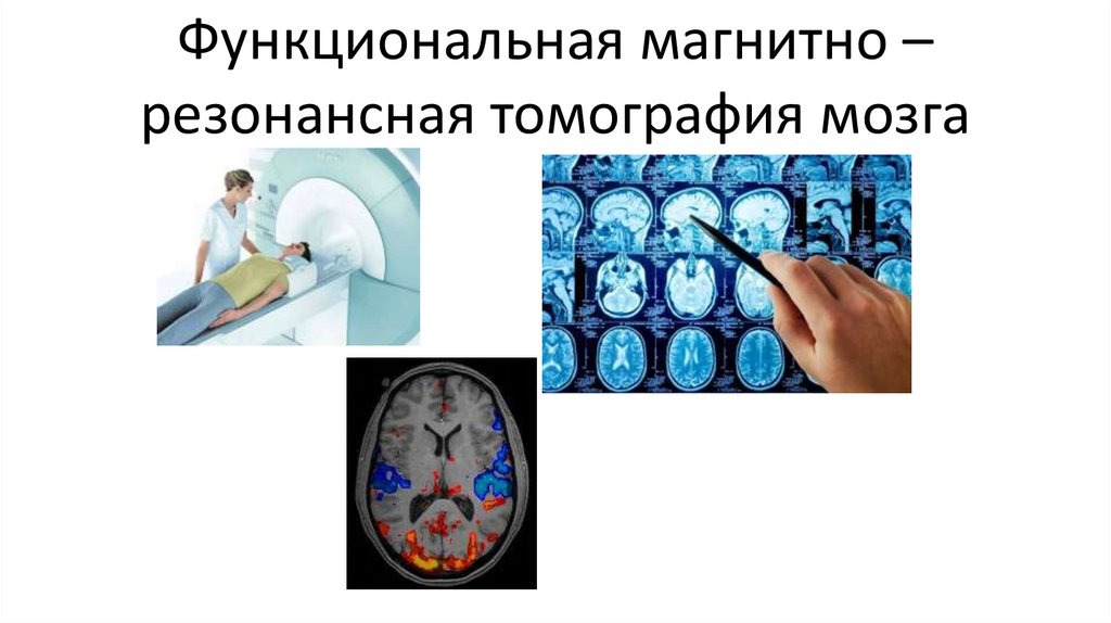 Функциональная магнитно –резонансная томография мозга