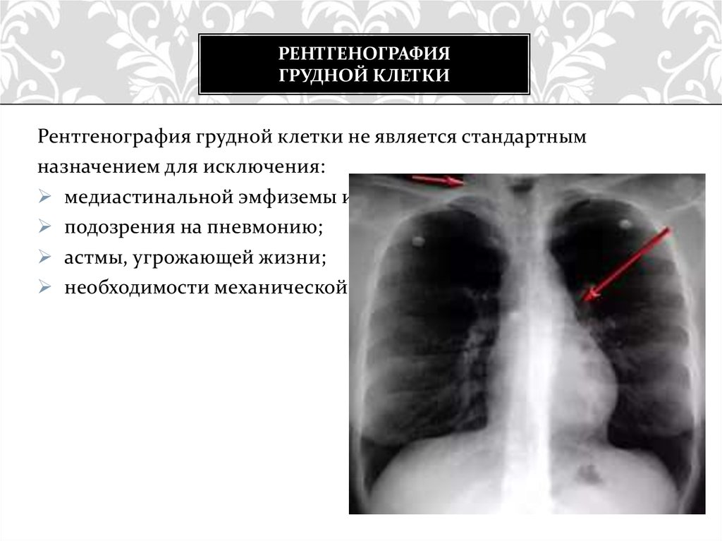 Рентгенологическая картина при хобл