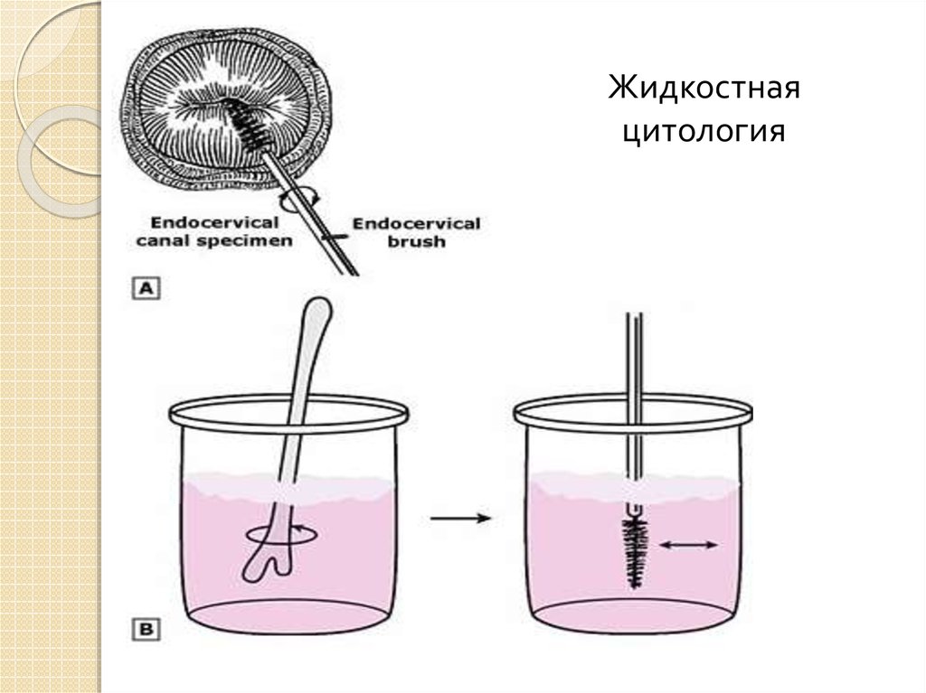 Как часто делают цитологию шейки. Жидкостная цитология. Контейнер для жидкостной цитологии. Метод жидкостной цитологии. Жидкостная цитология шейки.