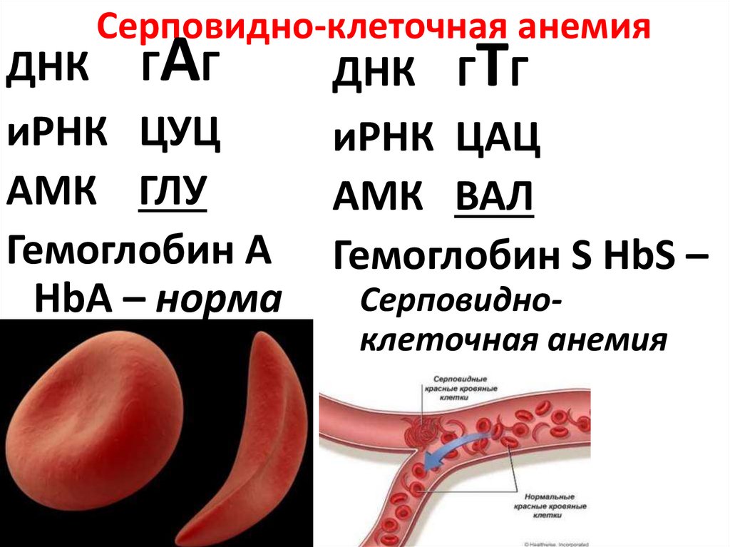 Серповидно клеточная анемия летальная рецессивная мутация