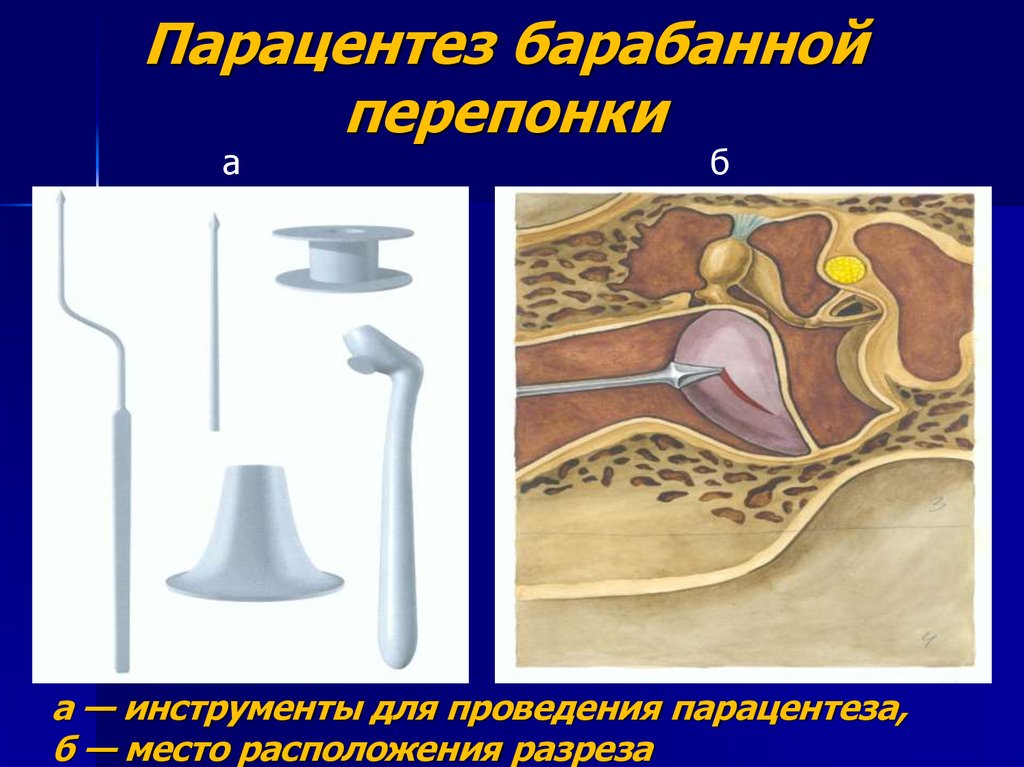 Отит карта смп