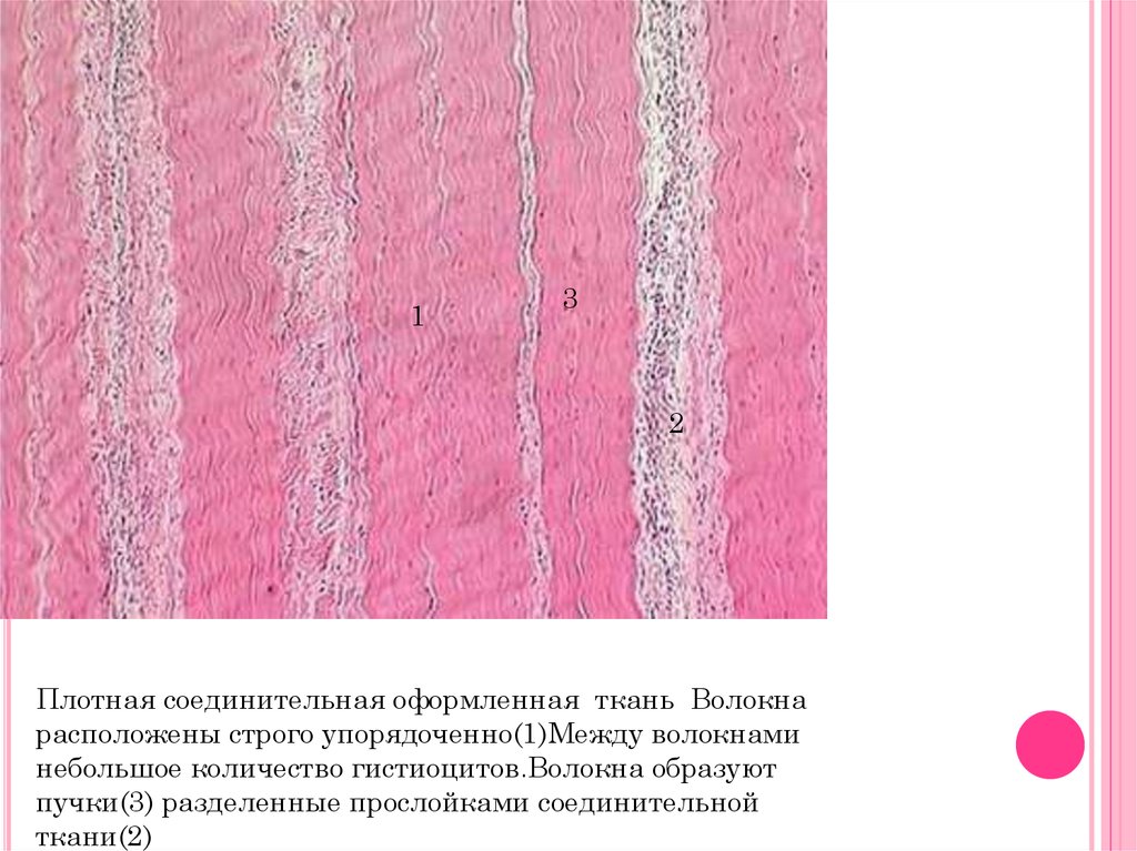 Ткань 1 соединительная. Плотная оформленная соединительная ткань препарат. Плотная коллагеновая соединительная ткань. Плотная волокнистая оформленная соединительная ткань препарат. Плотная оформленная соединительная ткань гистология.