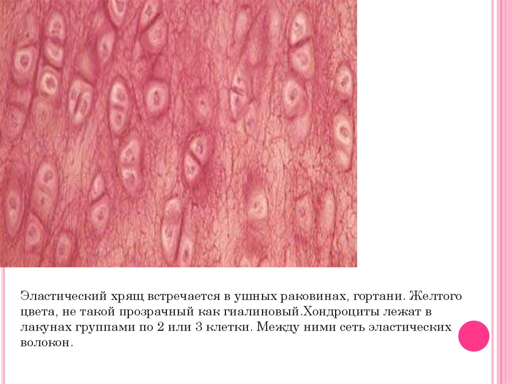 Эластический хрящ гистология рисунок