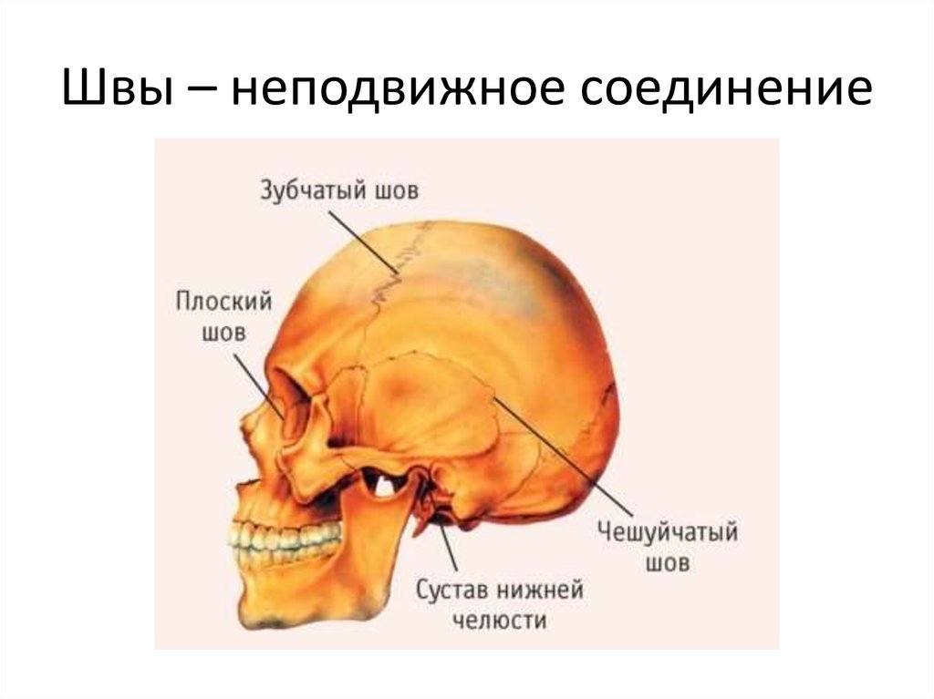 Соединение теменной кости и затылочной. Соединение костей черепа. Соединение костей черепа анатомия. Соединение костей черепа швы. Тип соединения костей черепа.