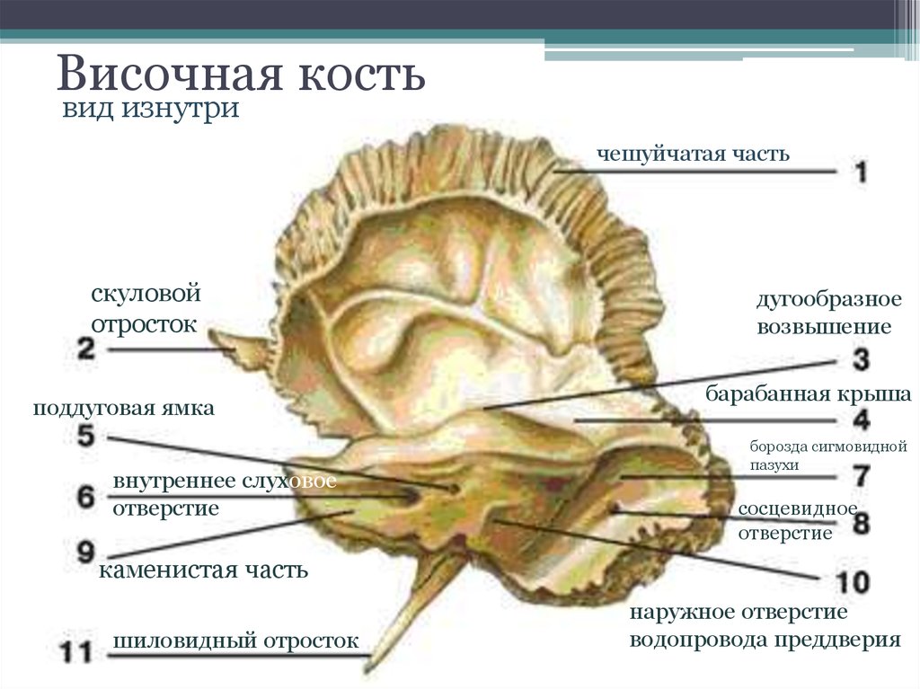 Пирамида кости. Пирамида (каменистая часть) височной кости. Височная кость пирамида анатомия. Височная кость вид снаружи и изнутри. Пирамида височной кости каменистая часть анатомия.