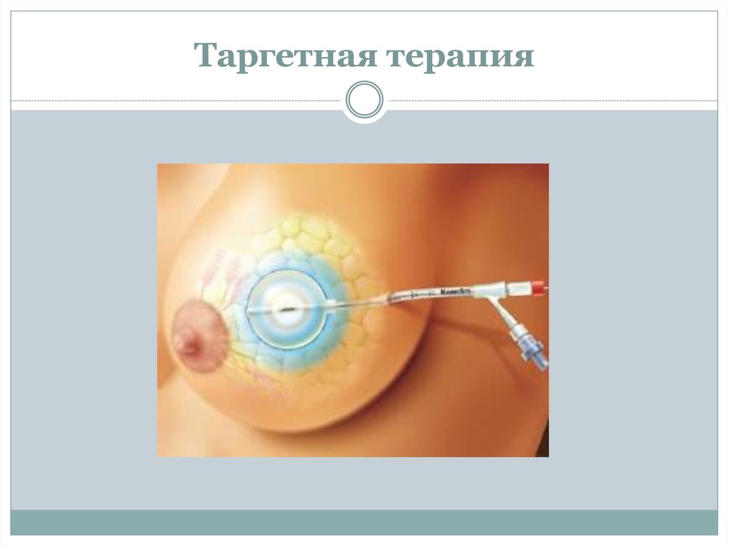 Таргетная терапия в онкологии что это. Выпадают волосы при таргетной терапии. Таргетная терапия ЗНО. Артлегией таргентная терапия. Таргетная терапия в онкологии выпадают волосы.