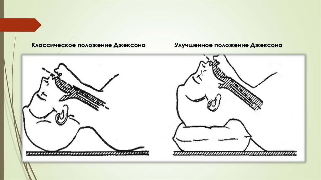 Положение улучшилось