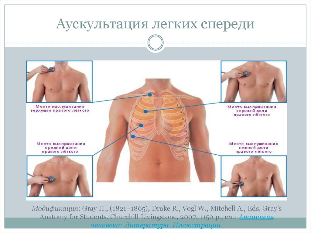 Точки легких. Аускультация грудной клетки алгоритм. Точки аускультации лёгких алгоритм. Точки аускультации легких схема. Проведение аускультации легких сзади.