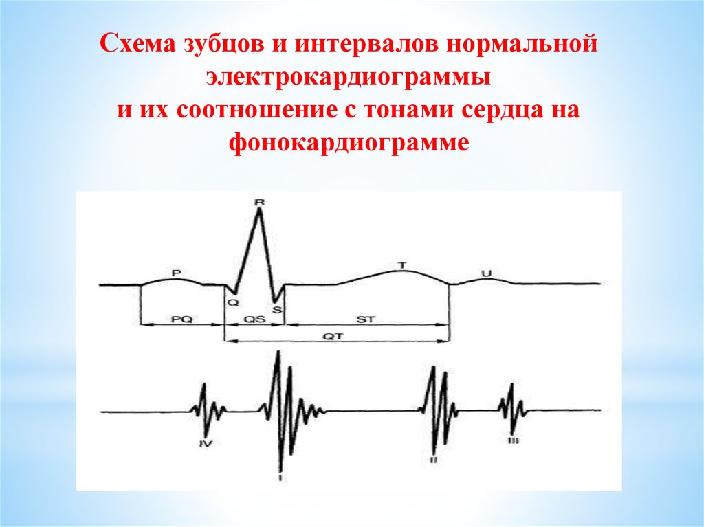 Схема экг. Тоны сердца на ЭКГ. Фонокардиограмма. Фонокардиограмма тоны сердца. IV тон сердца на фонокардиограмме регистрируется.