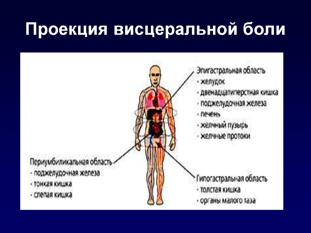 Висцеральная боль