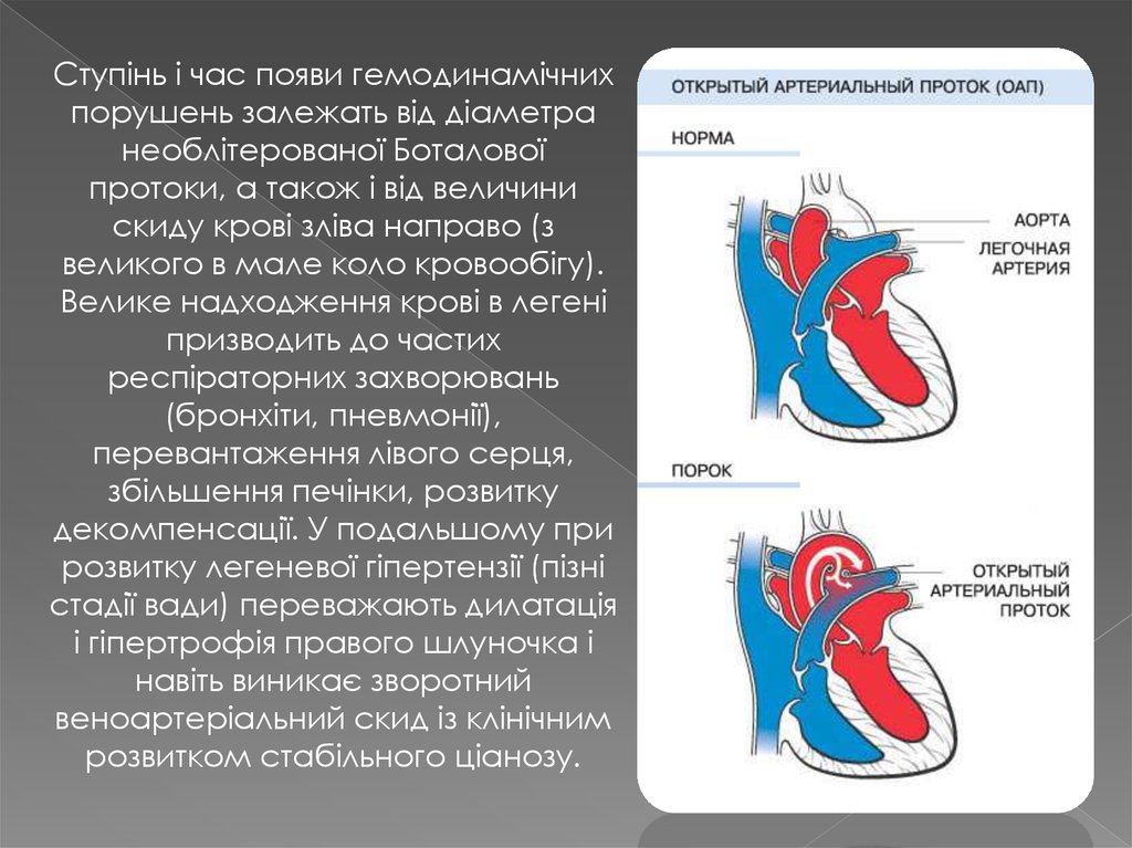 Оап у новорожденных. Открытый артериальный проток. Открытый артериальный проток презентация. Боталлов проток.