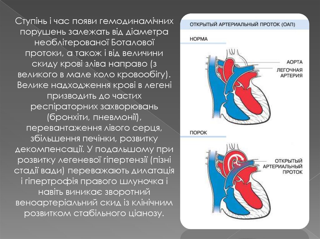 Открытый артериальный проток презентация