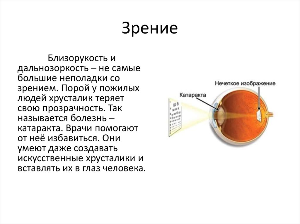 Презентация по физике близорукость