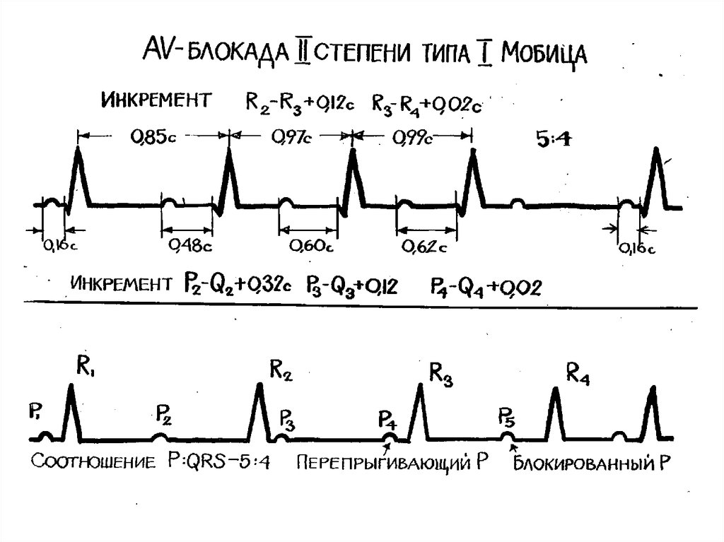 Экг под. ЭКГ расшифровка шпаргалка. Шпоры по ЭКГ. Лекции по ЭКГ. Шпаргалка по ЭКГ для студентов.