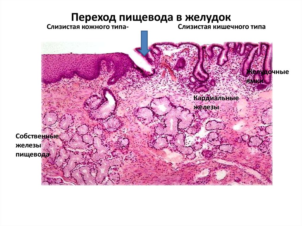 Желудок гистология