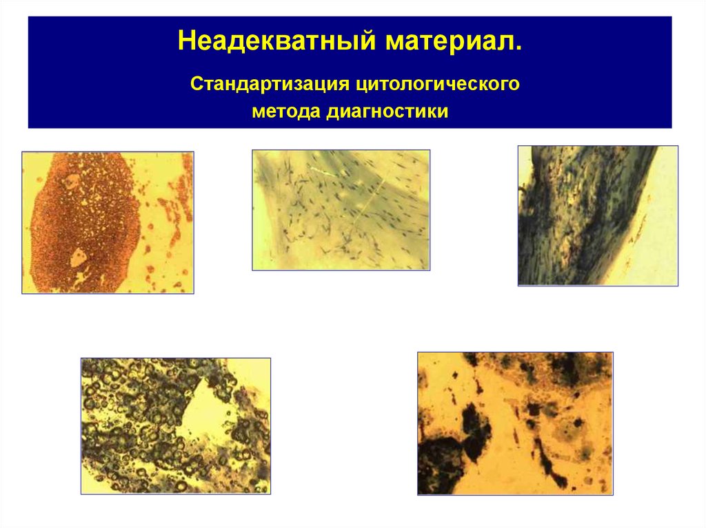 Цитологический метод. Цитологический метод диагностики. Цитологического метода. Недостатки цитологического метода. К недостатку цитологического метода диагностики.