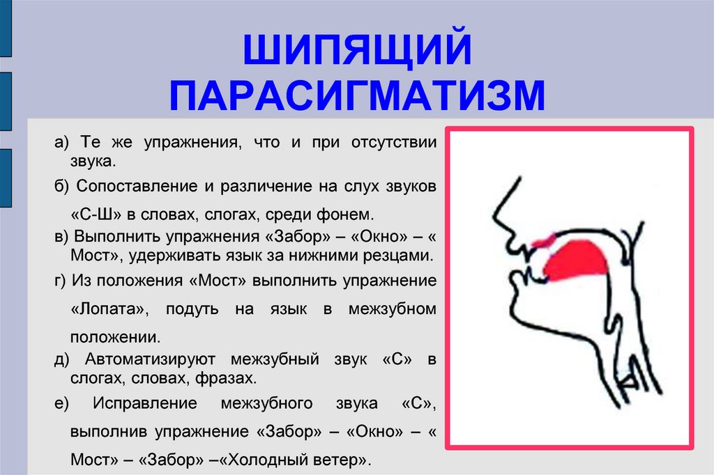 Этапы звука произношения. Губно-зубной сигматизм шипящих звуков. Межзубный свистящий сигматизм. Губно-зубной парасигматизм шипящих коррекция. Шипящий сигматизм.