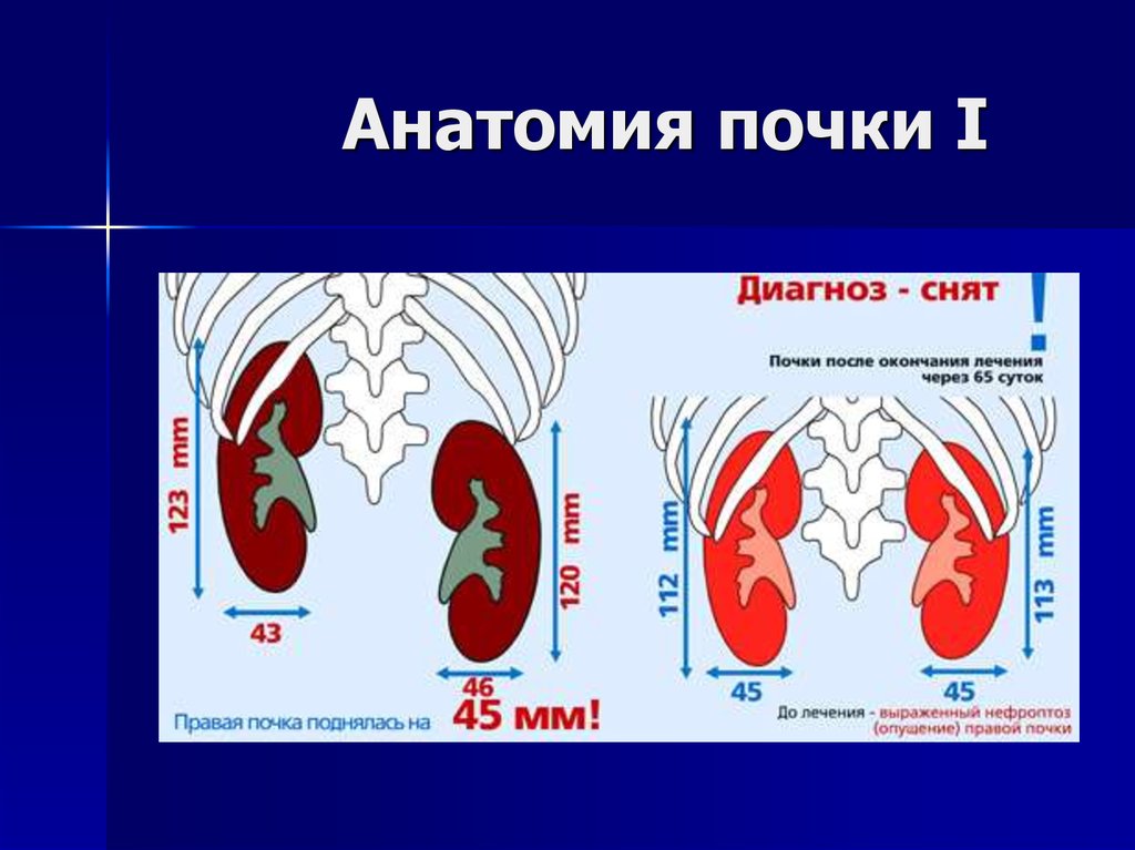 Одна почка ниже другой