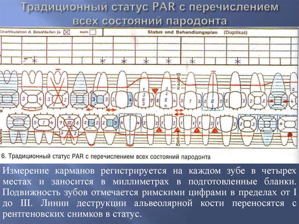 Диагностика пародонта. Обследование пациентов с заболеваниями пародонта.