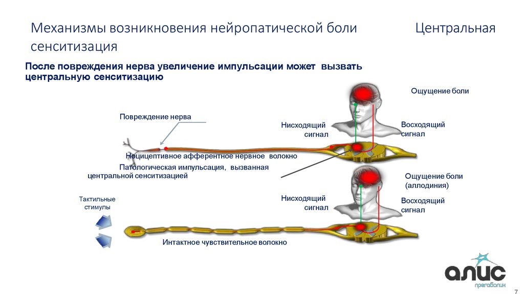 Высший болевой центр расположен в