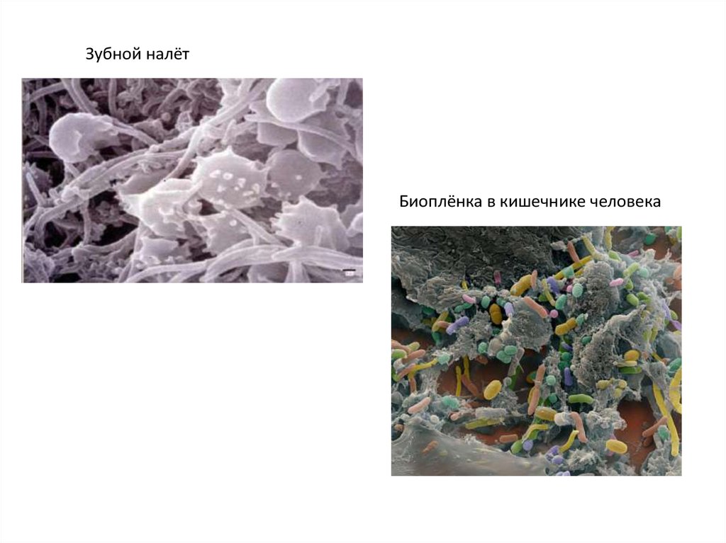 Биопленки кандиды. Биопленки микроорганизмов в кишечнике. Биопленка кандида. Pseudomonas биопленка. Биопленка микробиология.