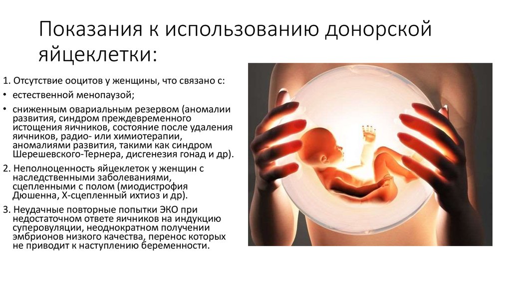 Подсадка эмбриона суррогатной матери. Донорские ооциты. Донорство яйцеклеток. Донорство яйцеклетки (ооцитов). Донорство оплодотворенной яйцеклетки.