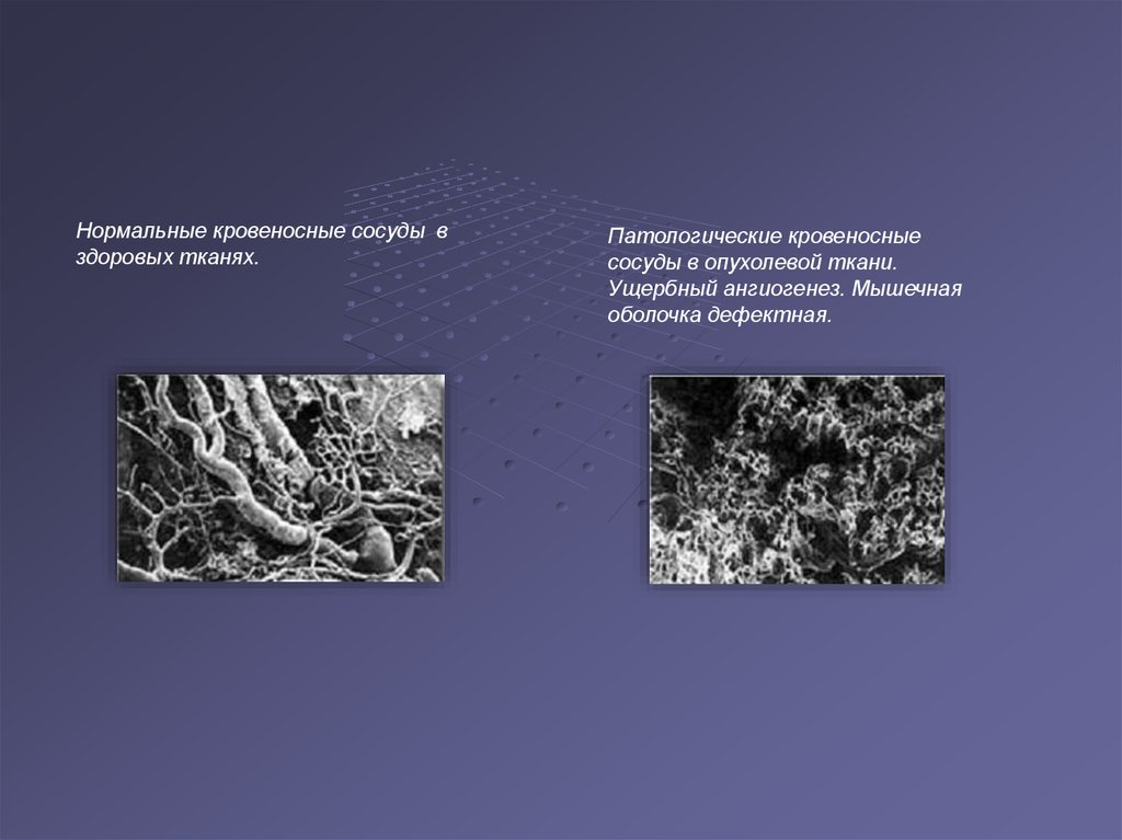 Нормальная ткань. Радиомодификация тканей. Патологическая ткань материаловедение. Что такое ущербная презентация. Искусственное ослабление массива картинка.