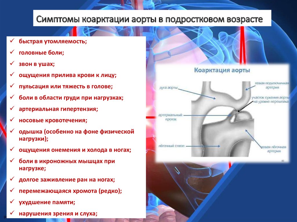 Коарктация аорты презентация