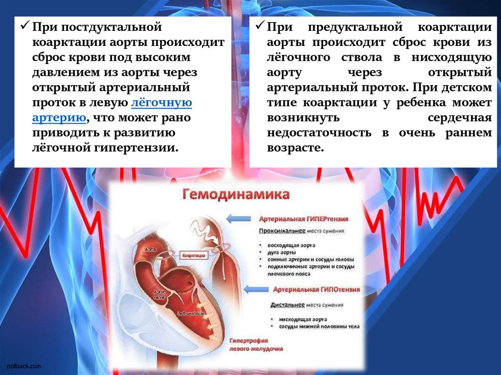 Давление сердца. Коарктация аорты презентация. Коарктация аорты артериальная гипертензия. Артериальное давление при коарктации аорты.