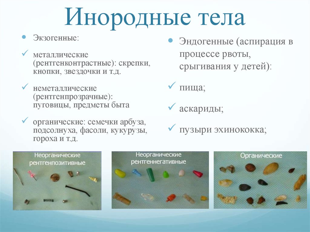 Микрофлора верхних дыхательных путей микробиология презентация