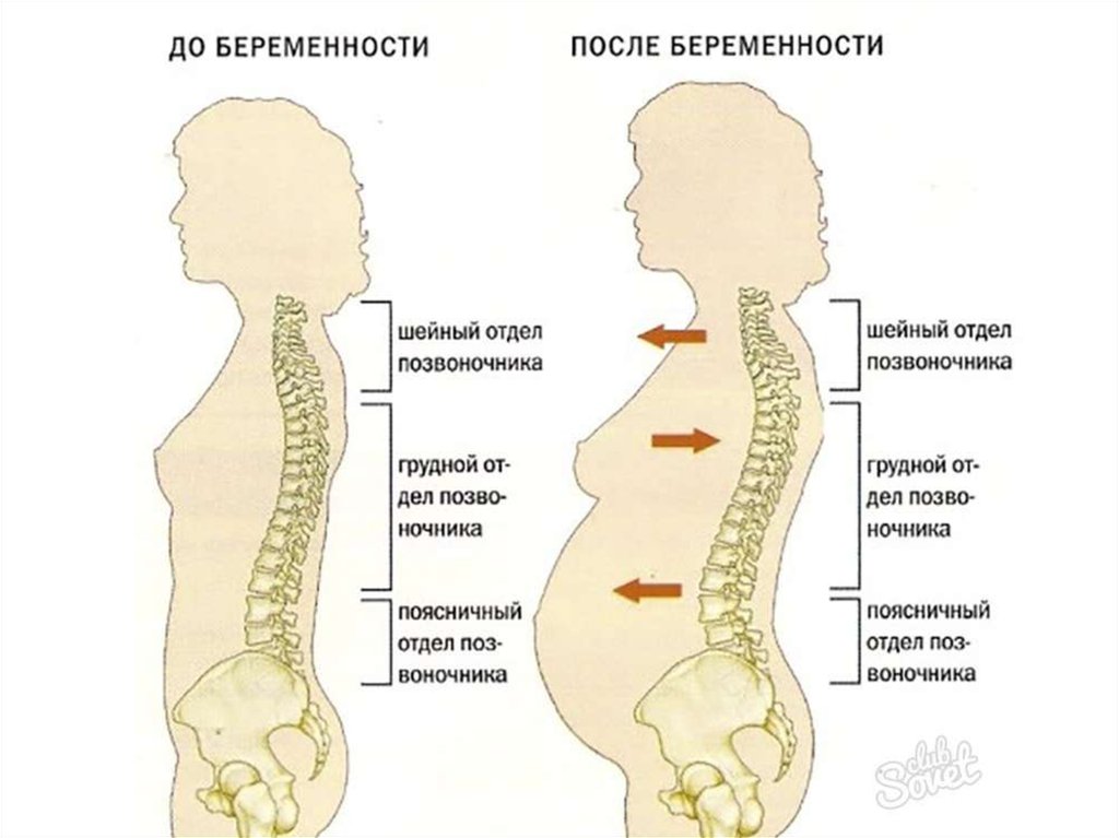 Поясница при беременности на ранних