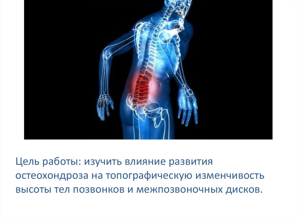 Цель работы: изучить влияние развития остеохондроза на топографическую изменчивость высоты тел позвонков и межпозвоночных