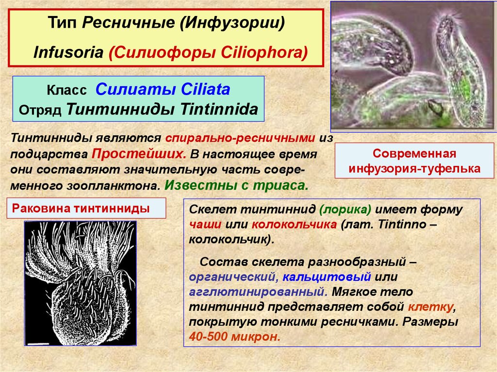 Виды инфузорий. Тип инфузории Ресничные. Тип инфузории (Ciliophora). Тип инфузории класс Ресничные. Тип инфузории или Ресничные (Ciliophora)..