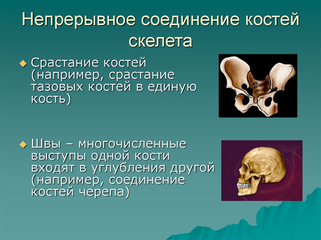 Соединение костей 6. Типы соединения костей 8 класс. Соединение костей скелета человека. Неподвижное соединение костей. Непрерывные соединения костей.