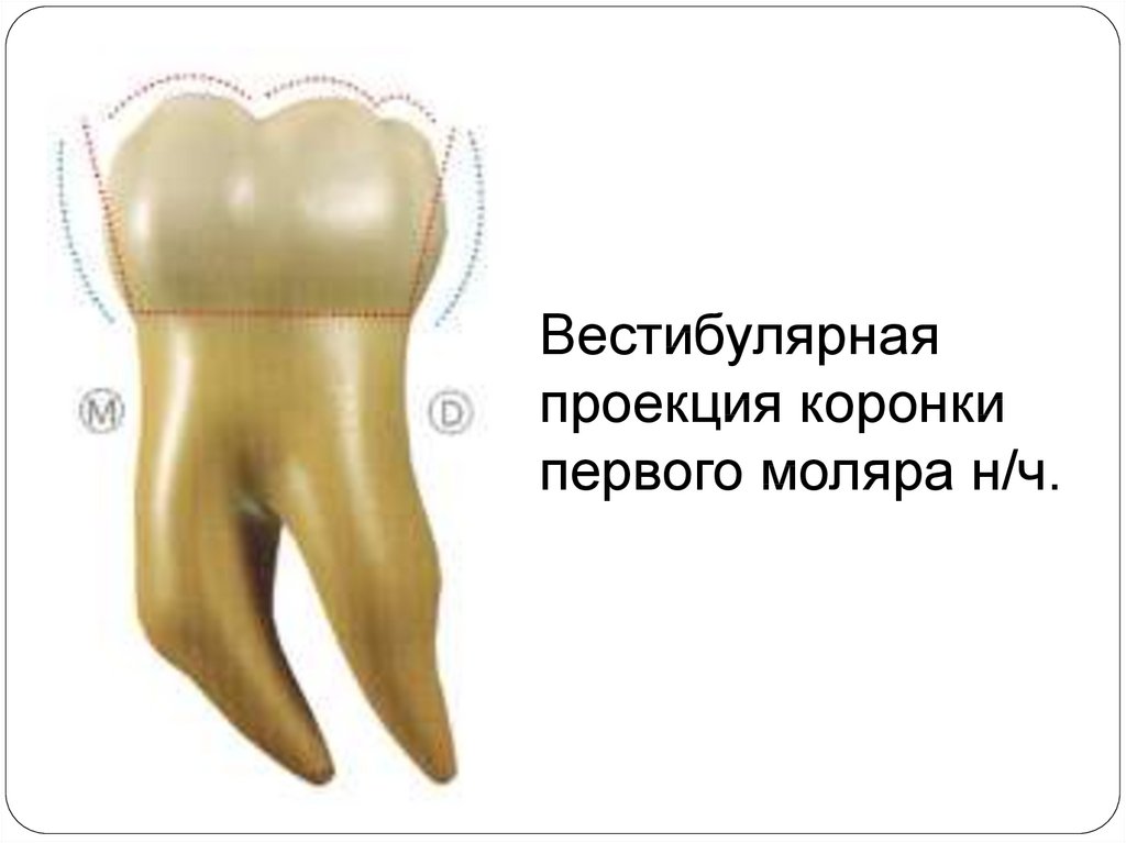 Презентация ортопедия коронки