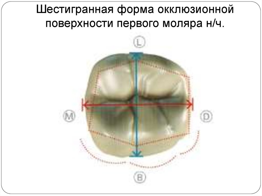 Бугры первого моляра верхней челюсти