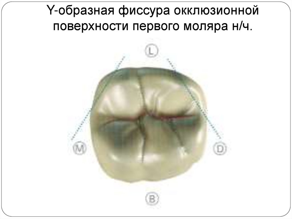 Фиссуры зубов схема