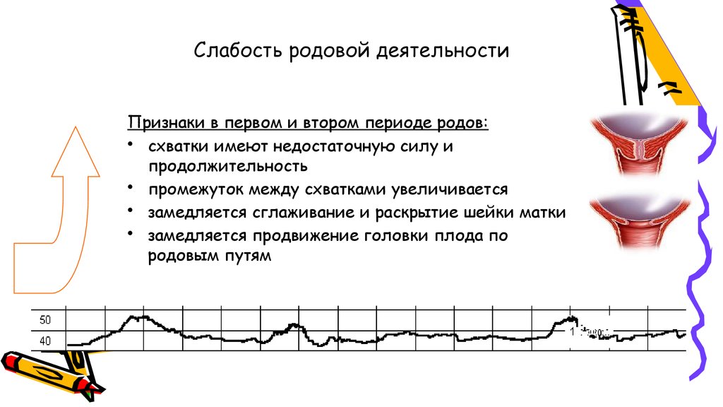 Слабость родовой деятельности презентация