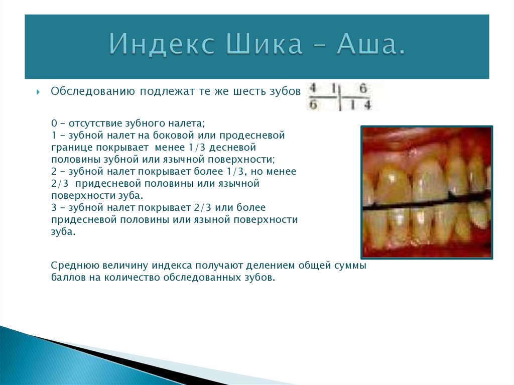 Индексная оценка состояния тканей пародонта презентация