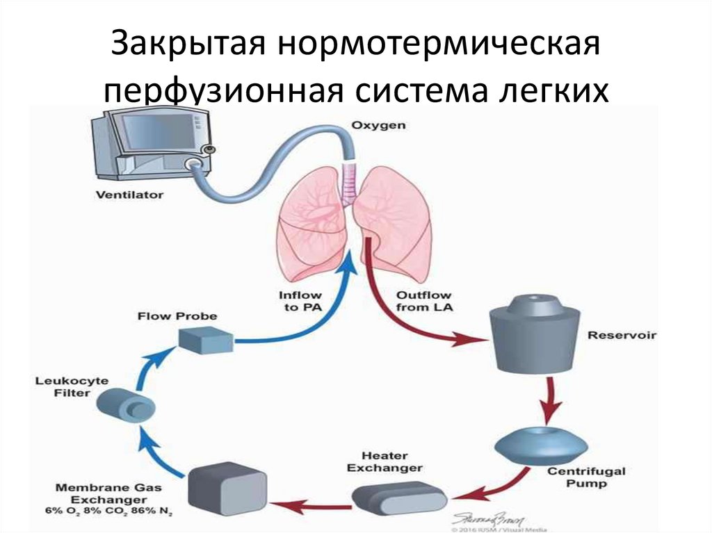 Система легких