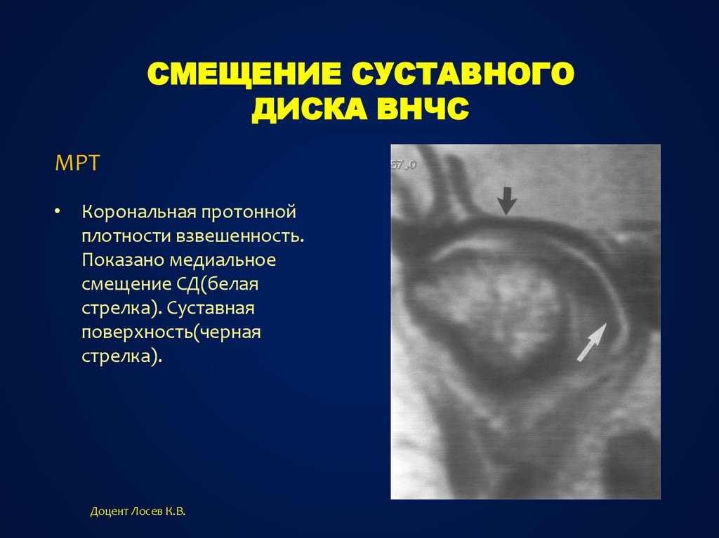 Дополнительные методы обследования внчс презентация