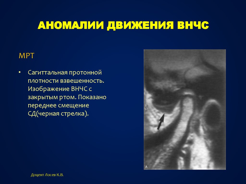 Дополнительные методы обследования внчс презентация