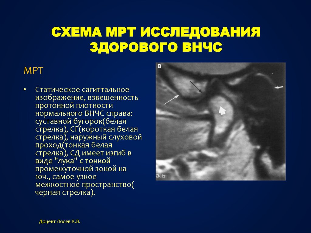 Дополнительные методы обследования внчс презентация