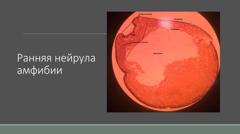 Ранняя нейрула амфибии