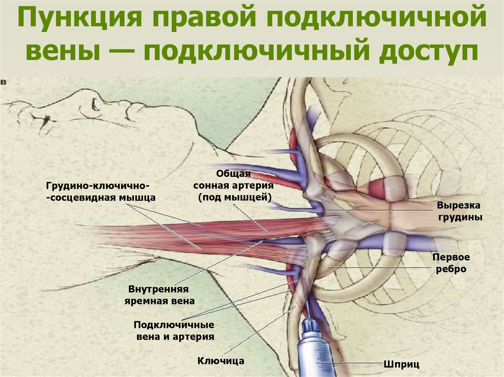 Яремная подключичная вены. Подключичная Вена топография. Проекция подключичной вены топографическая анатомия. Подключичная Вена топографическая анатомия. Подключичная Вена справа анатомия.