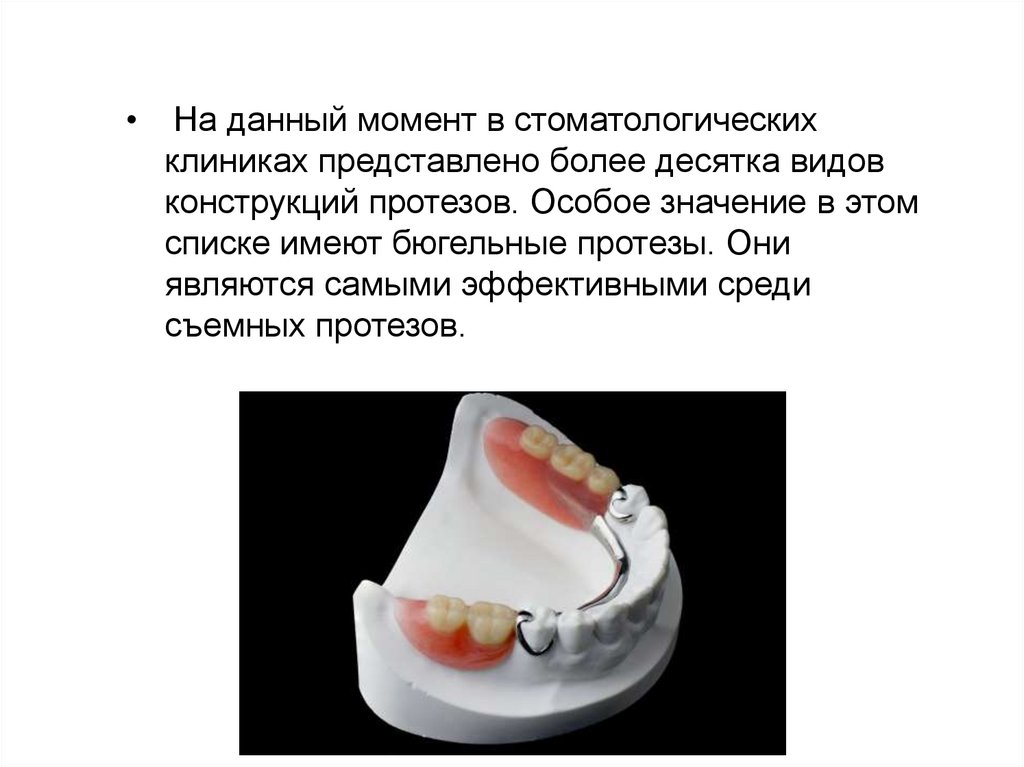 Презентация изготовление бюгельного протеза