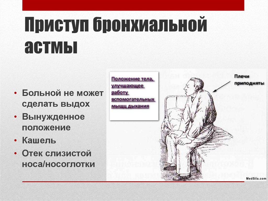 Какое положение наиболее. Приступ бронхиальной астмы. Приступ удушья при бронхиальной астме. Положение больного при бронхиальной астме. Положение при астматическом приступе.