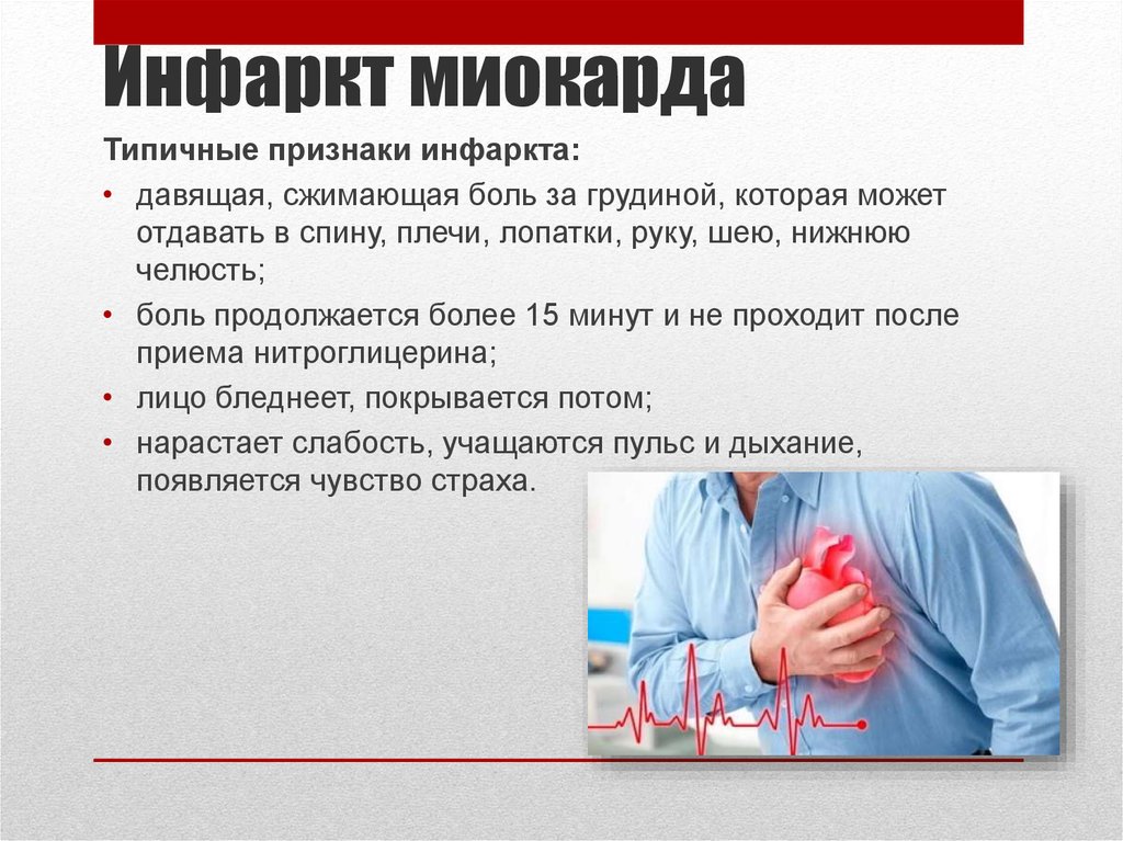 Первые признаки инфаркта у женщины симптомы 40. Острый инфаркт миокарда симптомы. Характерный признак типичного инфаркта миокарда. Клиника инфаркта миокарда. Клиеа инфаркта миокарда.